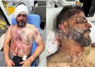 Vereador de Rondonópolis é vítima de tortura durante assalto em sua residência