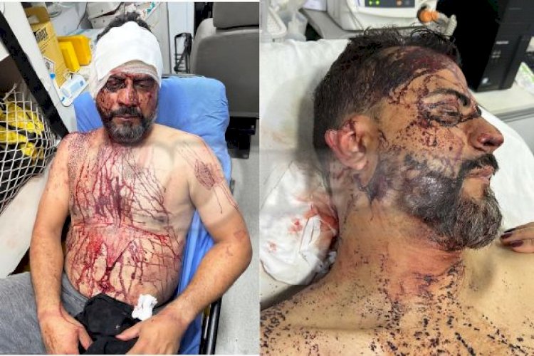Vereador de Rondonópolis é vítima de tortura durante assalto em sua residência