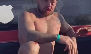 Casal de turistas de MT é agredido em Porto de Galinhas após cobrança por uso de cadeiras de praia: 'Eu vi a morte na nossa frente'