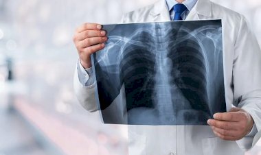 Casos de Síndrome Respiratória Aguda Grave começam a cair após cinco meses de alta no Brasil
