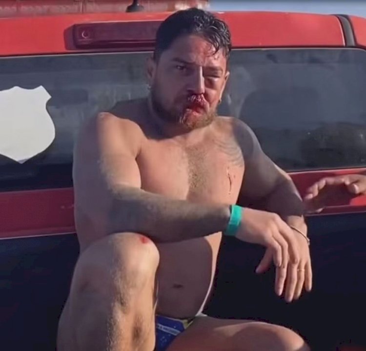 Casal de turistas de MT é agredido em Porto de Galinhas após cobrança por uso de cadeiras de praia: 'Eu vi a morte na nossa frente'